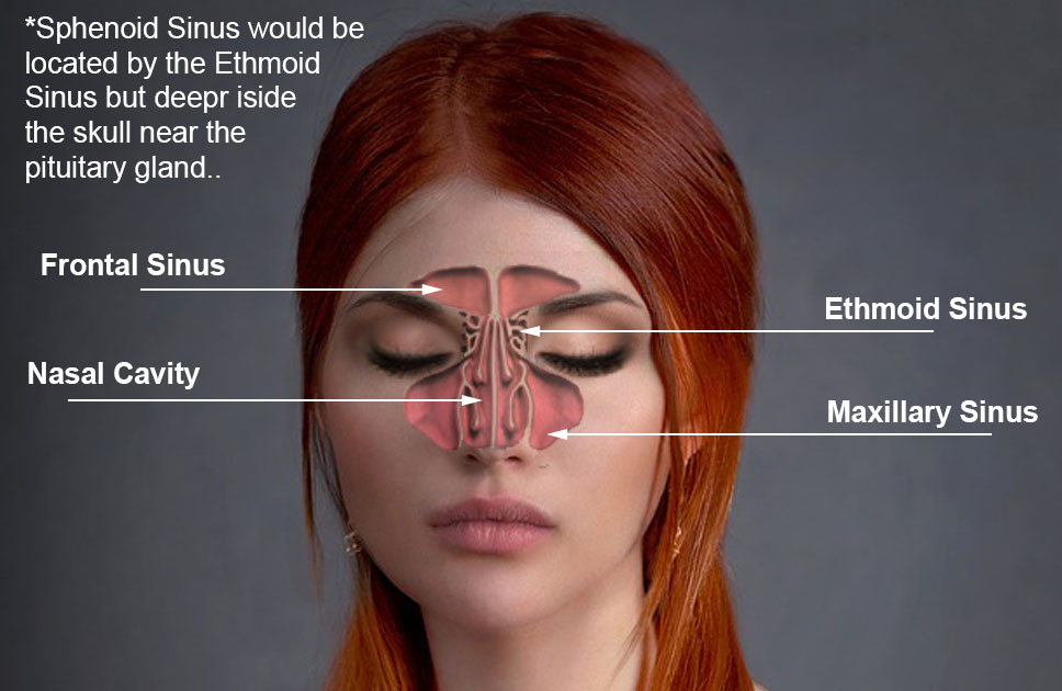 Infographic showing the location of the frontal sinus, maxillary sinus, nasal cavity, ethmoid sinus, and sphenoid sinus.